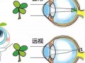 眼睛视力怎么看，眼睛视力怎么看懂检查报告